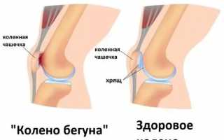 Почему ноет колено?