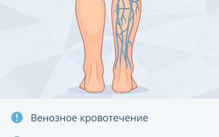 Главные причины тяжести в ногах