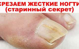 Как быстро размягчить ногти на ногах