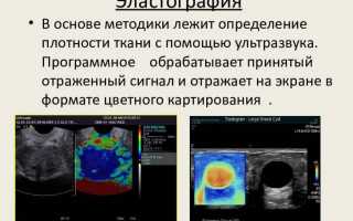 Что такое эластометрия или эластография печени