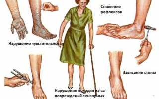 Заболевания ног на нервной почве: иннервация нижних конечностей