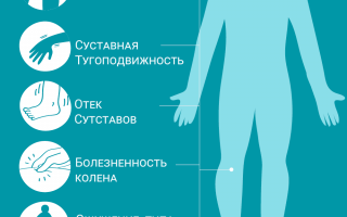 Симптомы артрита коленного сустава и методы его  лечения