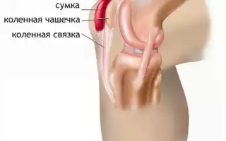Почему болит коленная чашечка?
