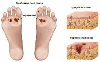 С какими болезнями стоп обращаться к врачу-подологу?