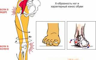 Когда и почему болят ноги: разбираемся в причинах
