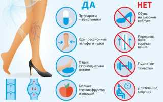 Варикоз вен на ногах: профилактика и лечение