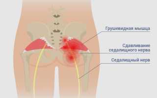 Несколько интересных фактов о грушевидной мышце