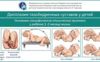 Причины незрелости тазобедренных суставов