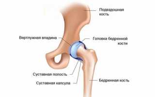 Главный герой – тазобедренный сустав