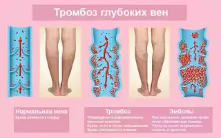Отчего тянет ноги?