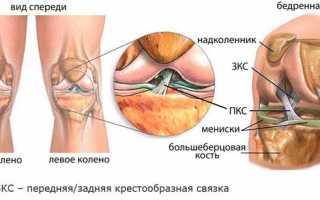 Если опухло и болит колено без ушиба – что это значит и как лечить