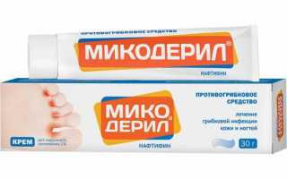 Хорошая мазь от грибка между пальцами на ногах