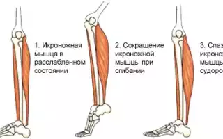 Причины судороги икроножных мышц