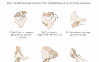Рекомендации по лечению плоскостопия у взрослых в домашних условиях