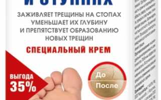 Мази и кремы для лечения трещин на пятках
