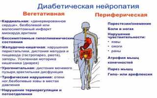 Причины диабетической полинейропатии нижних конечностей