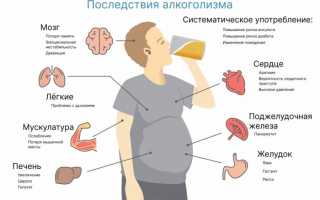 Симптомы алкоголизма