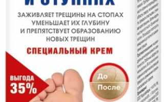 Эффективность кремов для ног от трещин на пятках