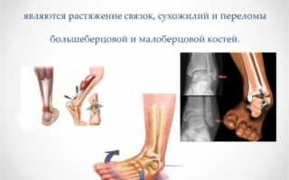 Голеностоп болит и отекает: травма или серьезный недуг?