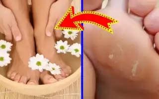 Как можно избавиться от мозолей на ногах?