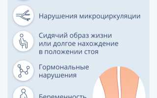Причины возникновения и лечение сосудистых звездочек на ногах