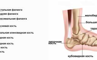 Какими могут быть признаки перелома пальца на ноге