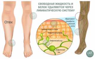 Время от времени отекают ноги и руки: почему такое случается?